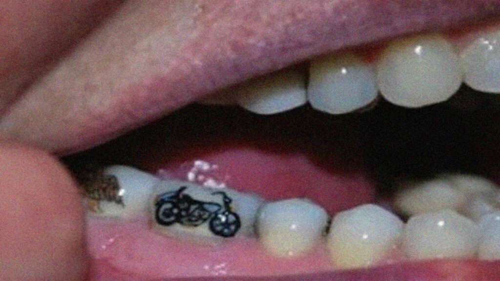 Tren Tato Gigi Merebak di China, Ahli Peringatkan Dampak Kesehatan